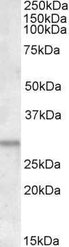 ATF5 Antibody in Western Blot (WB)