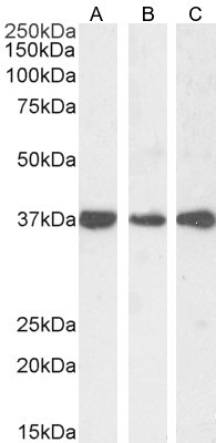 DDAH1 Antibody in Western Blot (WB)