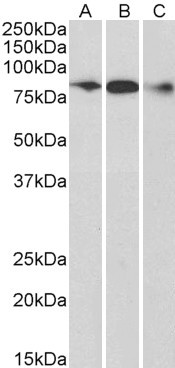 ELMO1 Antibody in Western Blot (WB)