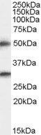 Spinesin Antibody in Western Blot (WB)