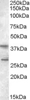 SKAP2 Antibody in Western Blot (WB)