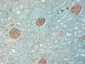 NQO1 Antibody in Immunohistochemistry (Paraffin) (IHC (P))