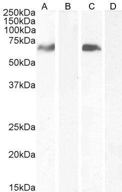 MARK4 Antibody in Western Blot (WB)