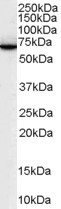 SWAP70 Antibody in Western Blot (WB)