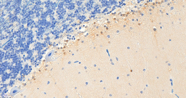 PEBP1 Antibody in Immunohistochemistry (Paraffin) (IHC (P))