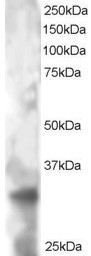 TSPAN32 Antibody in Western Blot (WB)