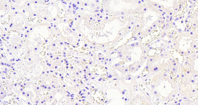 AKR1A1 Antibody in Immunohistochemistry (Paraffin) (IHC (P))