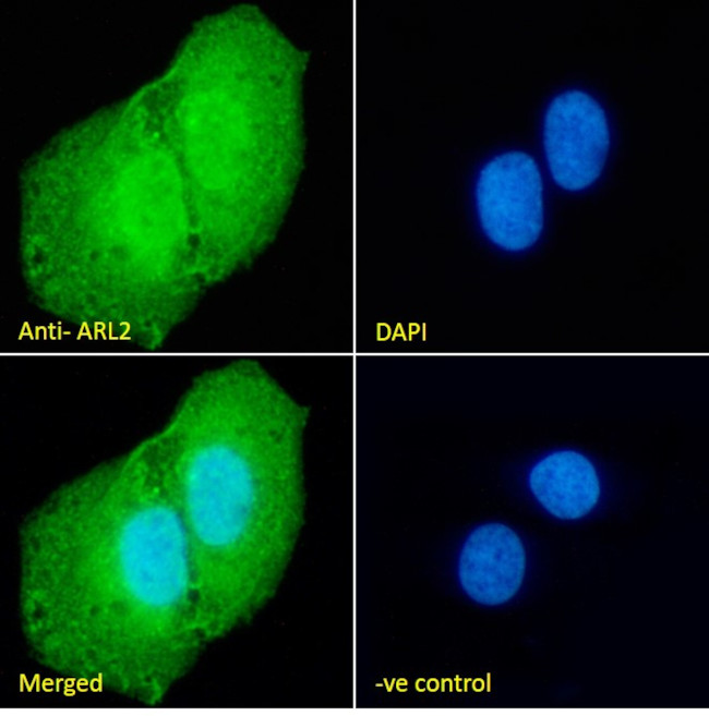 ARL2 Antibody in Immunocytochemistry (ICC/IF)