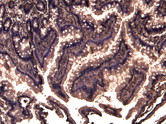 TRIM5 alpha/gamma/delta Antibody in Immunohistochemistry (Paraffin) (IHC (P))