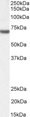 FANCG Antibody in Western Blot (WB)