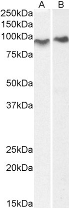 ACAP2 Antibody in Western Blot (WB)