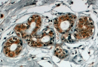 SNX5 Antibody in Immunohistochemistry (Paraffin) (IHC (P))