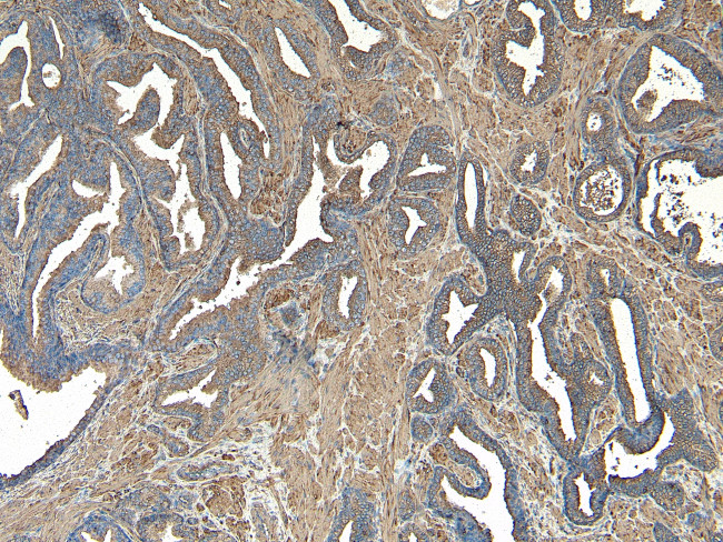 VPS35 Antibody in Immunohistochemistry (Paraffin) (IHC (P))