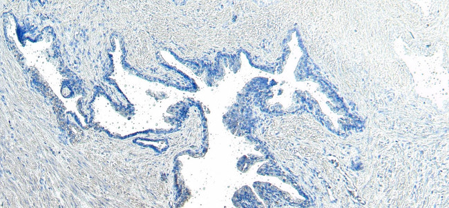 VPS35 Antibody in Immunohistochemistry (Paraffin) (IHC (P))