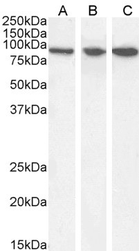 VPS35 Antibody in Western Blot (WB)