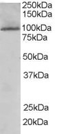 JIK Antibody in Western Blot (WB)