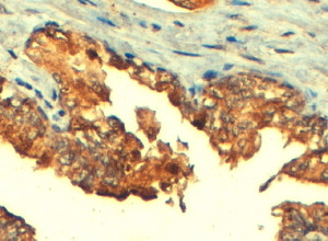 MRP4 Antibody in Immunohistochemistry (Paraffin) (IHC (P))