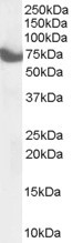 ZDHHC17 Antibody in Western Blot (WB)