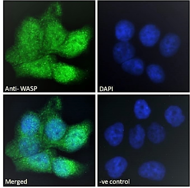 WASP Antibody in Immunocytochemistry (ICC/IF)