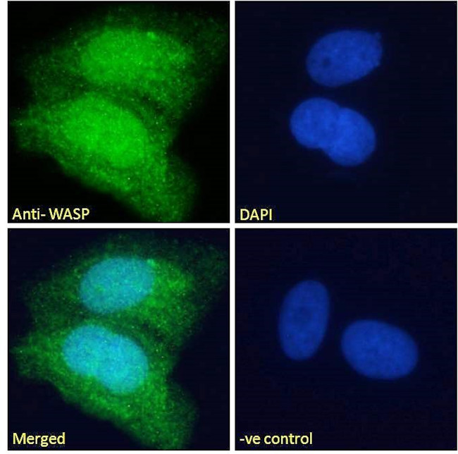 WASP Antibody in Immunocytochemistry (ICC/IF)