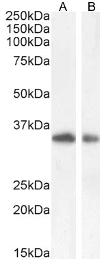 TIM3 Antibody in Western Blot (WB)