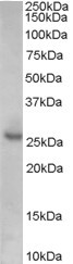 p27 Kip1 Antibody in Western Blot (WB)