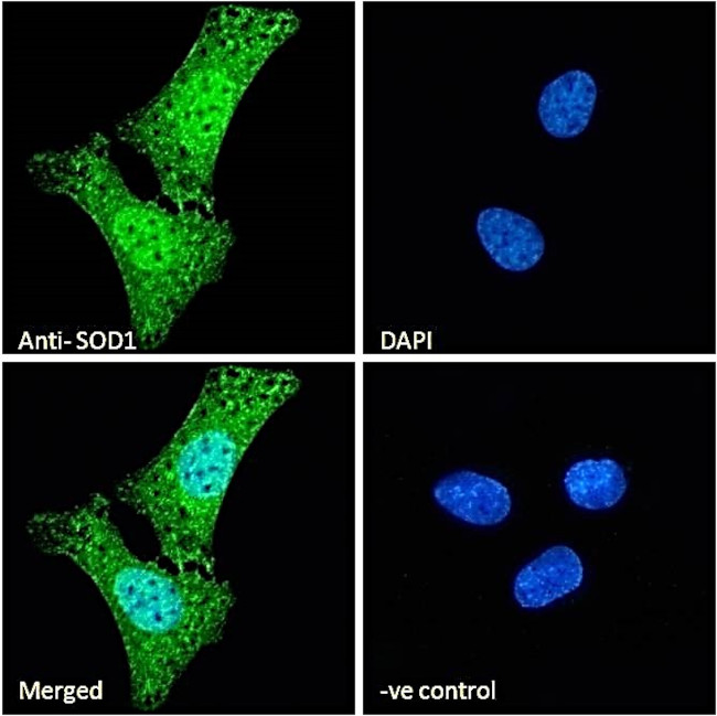 SOD1 Antibody in Immunocytochemistry (ICC/IF)