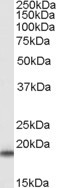 SOD1 Antibody in Western Blot (WB)