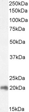 ZNF9 Antibody in Western Blot (WB)