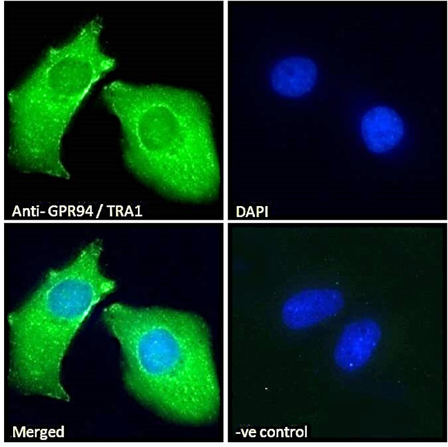 GRP94 Antibody in Immunocytochemistry (ICC/IF)