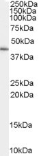 GATA5 Antibody in Western Blot (WB)