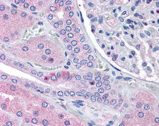 RNF213 Antibody in Immunohistochemistry (Paraffin) (IHC (P))