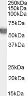 G6PD Antibody in Western Blot (WB)