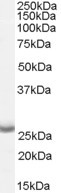 APH1 Antibody in Western Blot (WB)