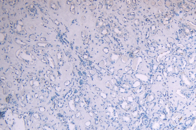 Myb Antibody in Immunohistochemistry (Paraffin) (IHC (P))