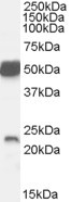 Neurturin Antibody in Western Blot (WB)