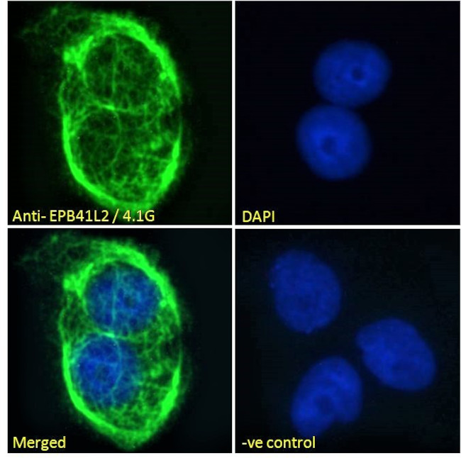 EPB41L2 Antibody in Immunocytochemistry (ICC/IF)