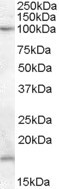 TEB4 Antibody in Western Blot (WB)