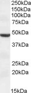 TMPRSS4 Antibody in Western Blot (WB)