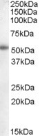 Aromatase Antibody in Western Blot (WB)