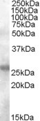 AID Antibody in Western Blot (WB)