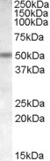 CHRNB3 Antibody in Western Blot (WB)