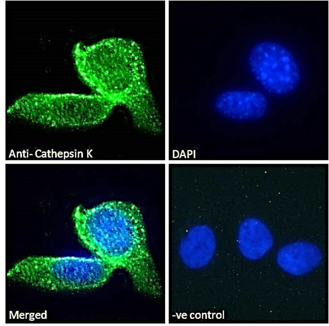 Cathepsin K Antibody in Immunocytochemistry (ICC/IF)