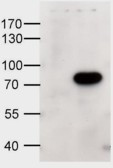 ABCD1 Antibody in Western Blot (WB)