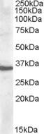 Apolipoprotein F Antibody in Western Blot (WB)