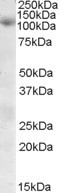 SNX19 Antibody in Western Blot (WB)