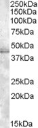 MBNL1 Antibody in Western Blot (WB)