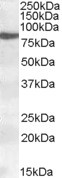 ALOX15 Antibody in Western Blot (WB)