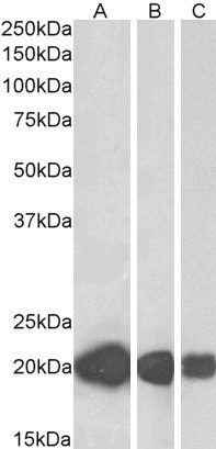 CSRP3 Antibody in Western Blot (WB)