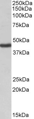 Kir1.1 (KCNJ1) Antibody in Western Blot (WB)